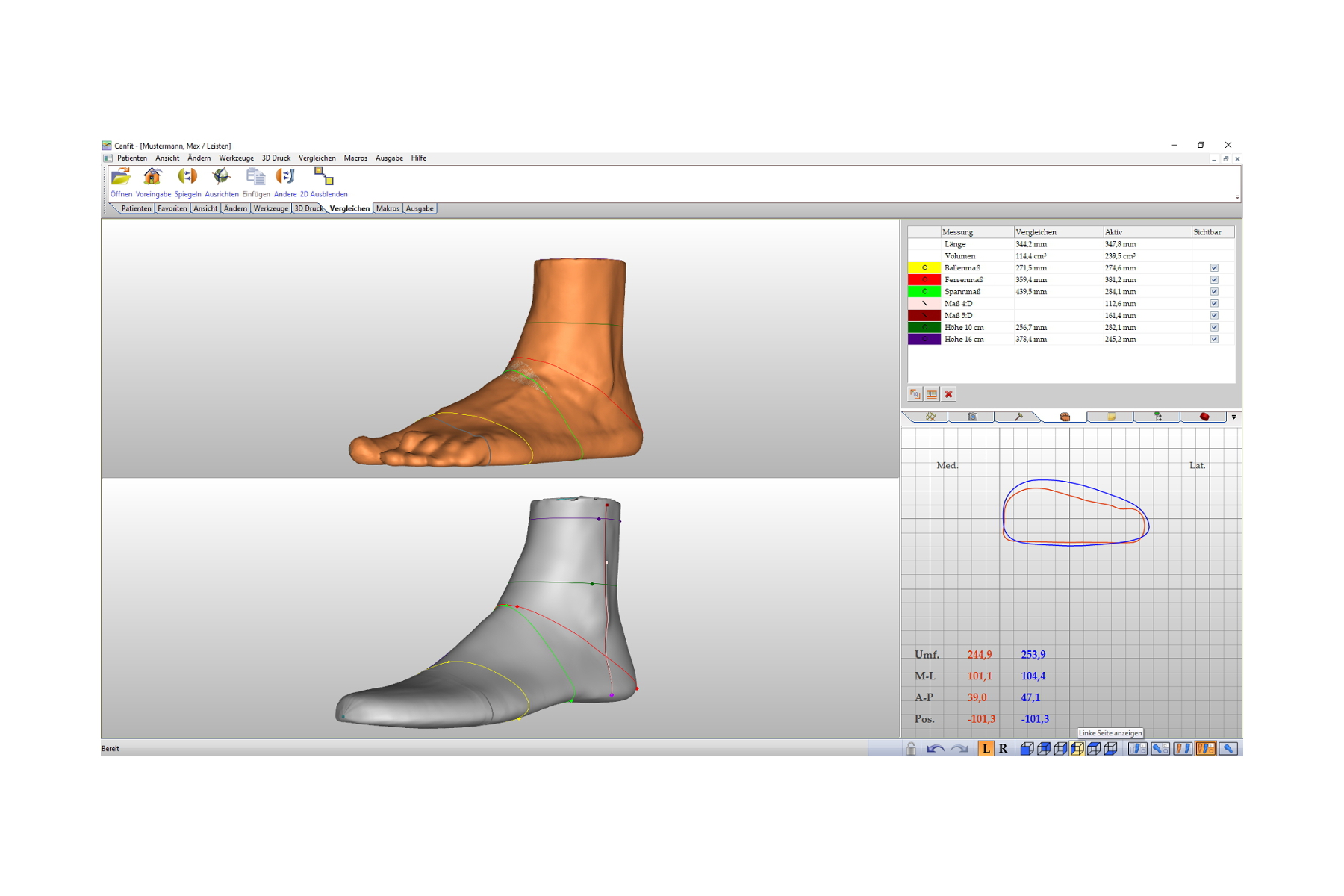 CAD-software and 3D-scanners